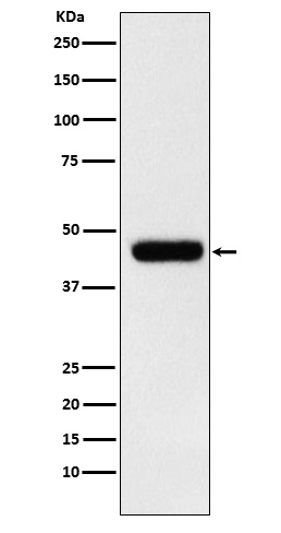 eIF4A1 Rabbit mAb