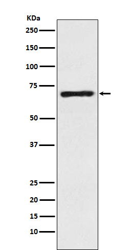 SLC6A1 / GAT1 Rabbit mAb