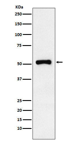 Retinoic Acid Receptor gamma Rabbit mAb