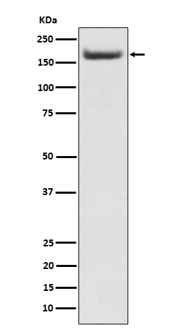 IRS2 Rabbit mAb