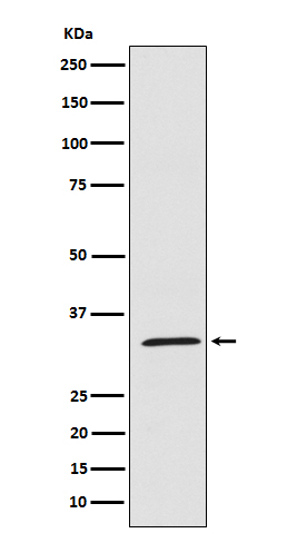 UCP1+UCP3 Rabbit mAb