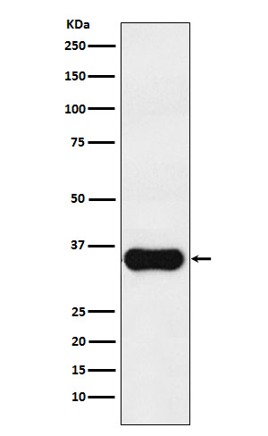 MC1 Receptor Rabbit mAb