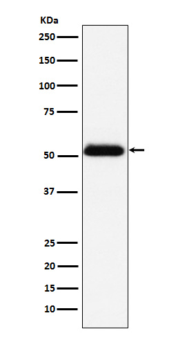 Prostatic Acid Phosphatase Rabbit mAb