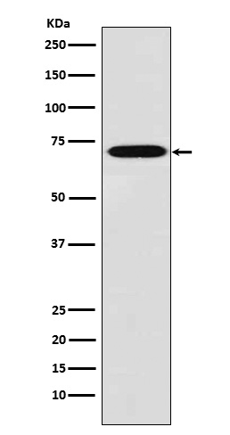 Plastin L Rabbit mAb