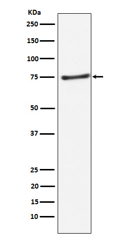 PIAS1 Rabbit mAb