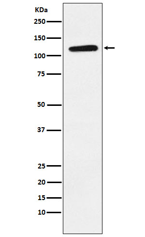 Eph receptor B1 Rabbit mAb