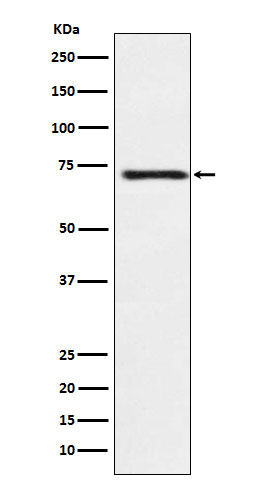 Guanylyl Cyclase beta 1 Rabbit mAb