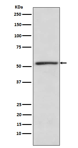 TBLR1 Rabbit mAb