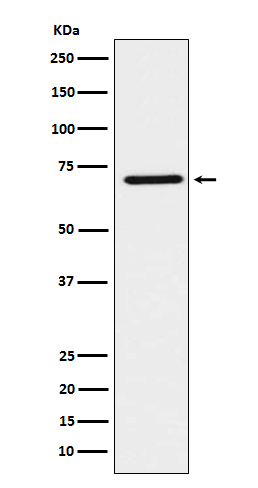 HNF1 beta Rabbit mAb