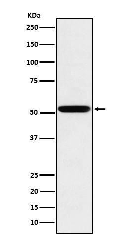 Human IgG2 Rabbit mAb