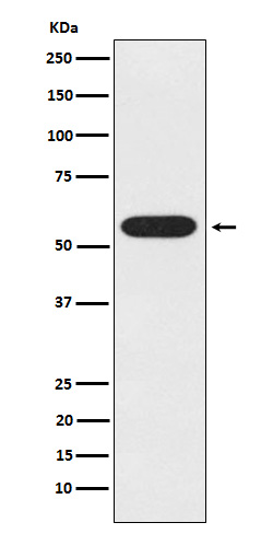 UAP1 Rabbit mAb