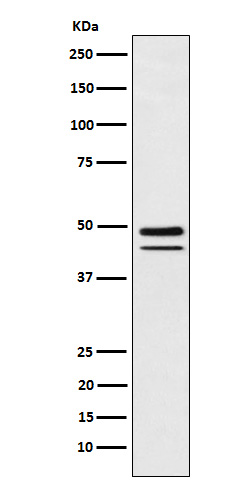 Brachyury Rabbit mAb