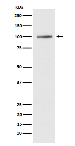 ATP2A1/SERCA1 Rabbit mAb