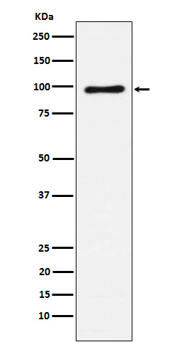 Vav1/2/3 Rabbit mAb