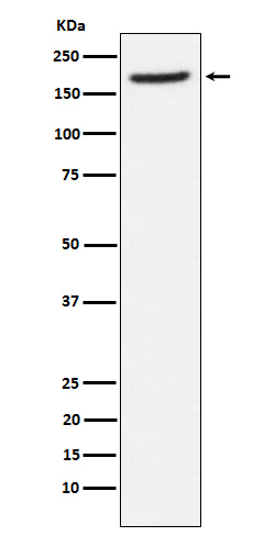 Aminopeptidase A / CD249 Rabbit mAb