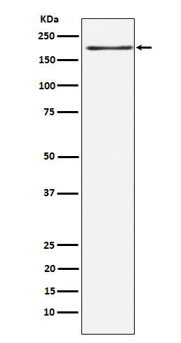 LRP6 Rabbit mAb