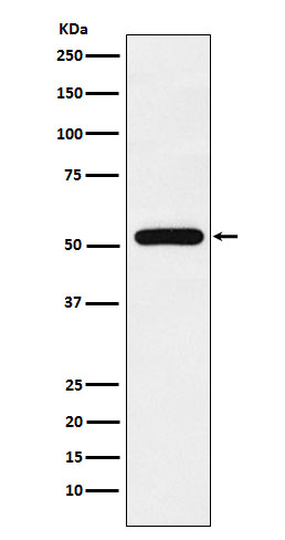 TAB1 Rabbit mAb