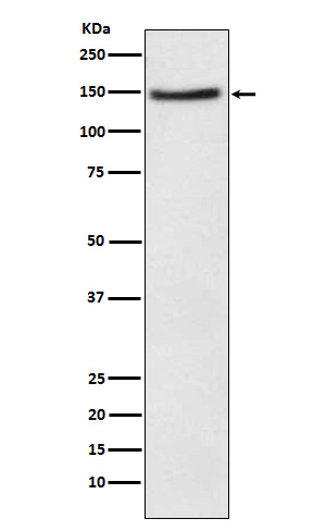 NPC1L1 Rabbit mAb