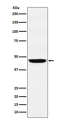 SEC61A Rabbit mAb