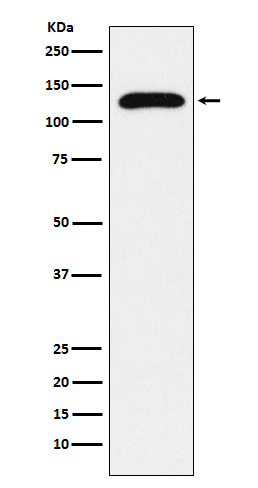 TRPC1 Rabbit mAb