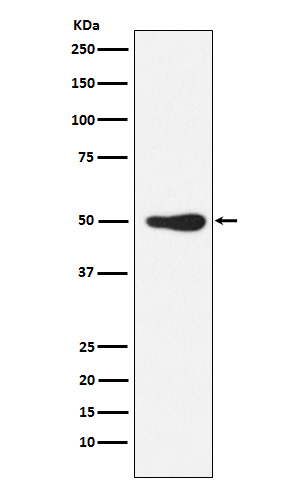 FOXL2 Rabbit mAb