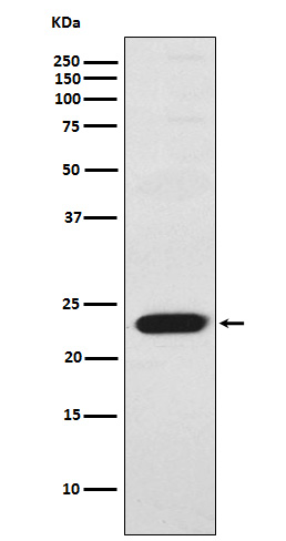 TNNI2 Rabbit mAb