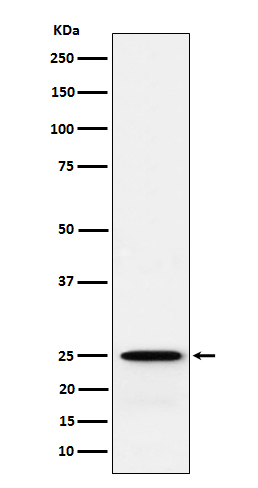 GSTK1 Rabbit mAb