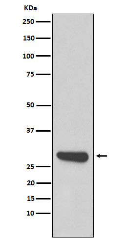 Calpain small subunit 1 Rabbit mAb