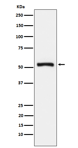 Tryptophanyl tRNA synthetase Rabbit mAb