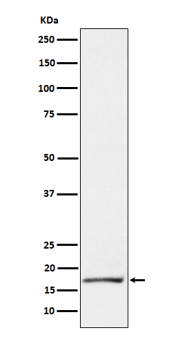 GCDFP 15 Rabbit mAb