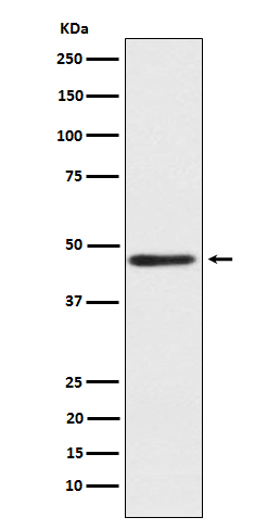 ENTPD5 Rabbit mAb