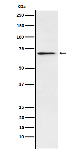 Plastin L Rabbit mAb