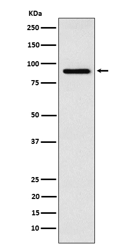 RSK4 Rabbit mAb