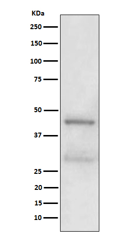 MBD2 Rabbit mAb