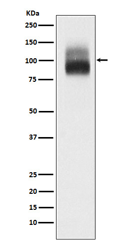 TrkB Rabbit mAb