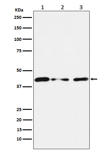 Tin2 Rabbit mAb