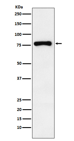 RNase L Rabbit mAb