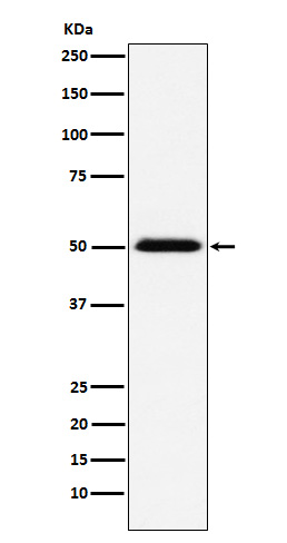 TCP1 beta Rabbit mAb