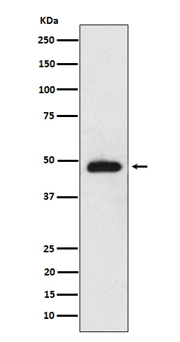 NeuroD2 Rabbit mAb