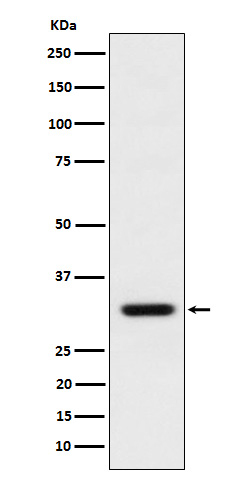 BCL2L12 Rabbit mAb