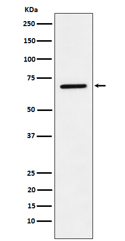 LTA4H Rabbit mAb