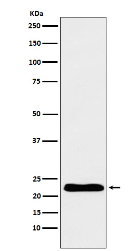 TNNI1 Rabbit mAb