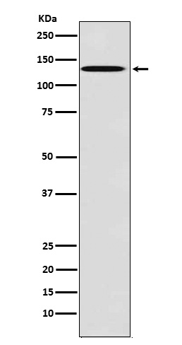 TYRO3 Rabbit mAb