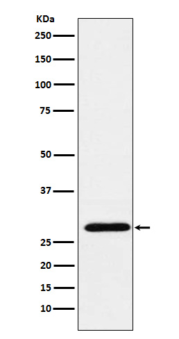 RGS18 Rabbit mAb