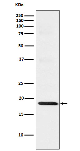 TOMM22/TOM22 Rabbit mAb