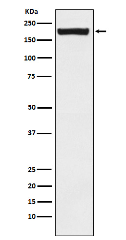 MRC2/ENDO180 Rabbit mAb