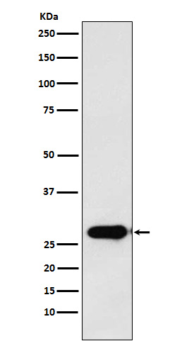 Calpain S1 Rabbit mAb