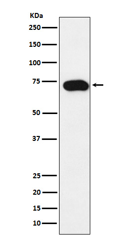 SLC22A1 Rabbit mAb