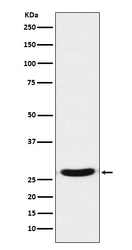 TCF21 Rabbit mAb