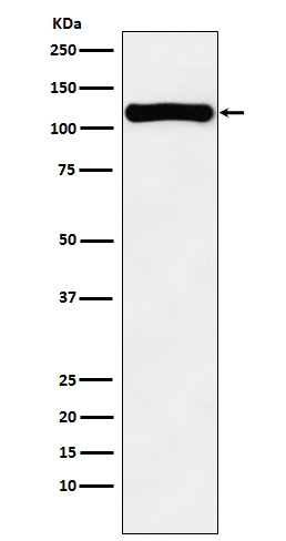 VPS11 Rabbit mAb